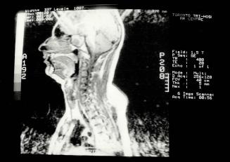 Magnetic resonance image