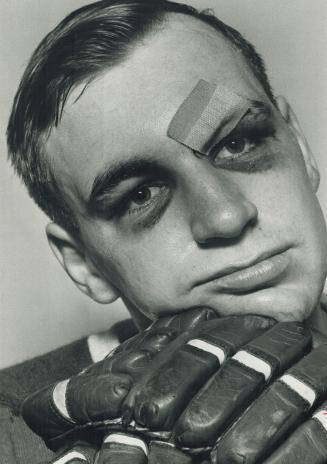 Two lovely black eyes, This has been tough season for Toronto Marlboros Mike Corrigan