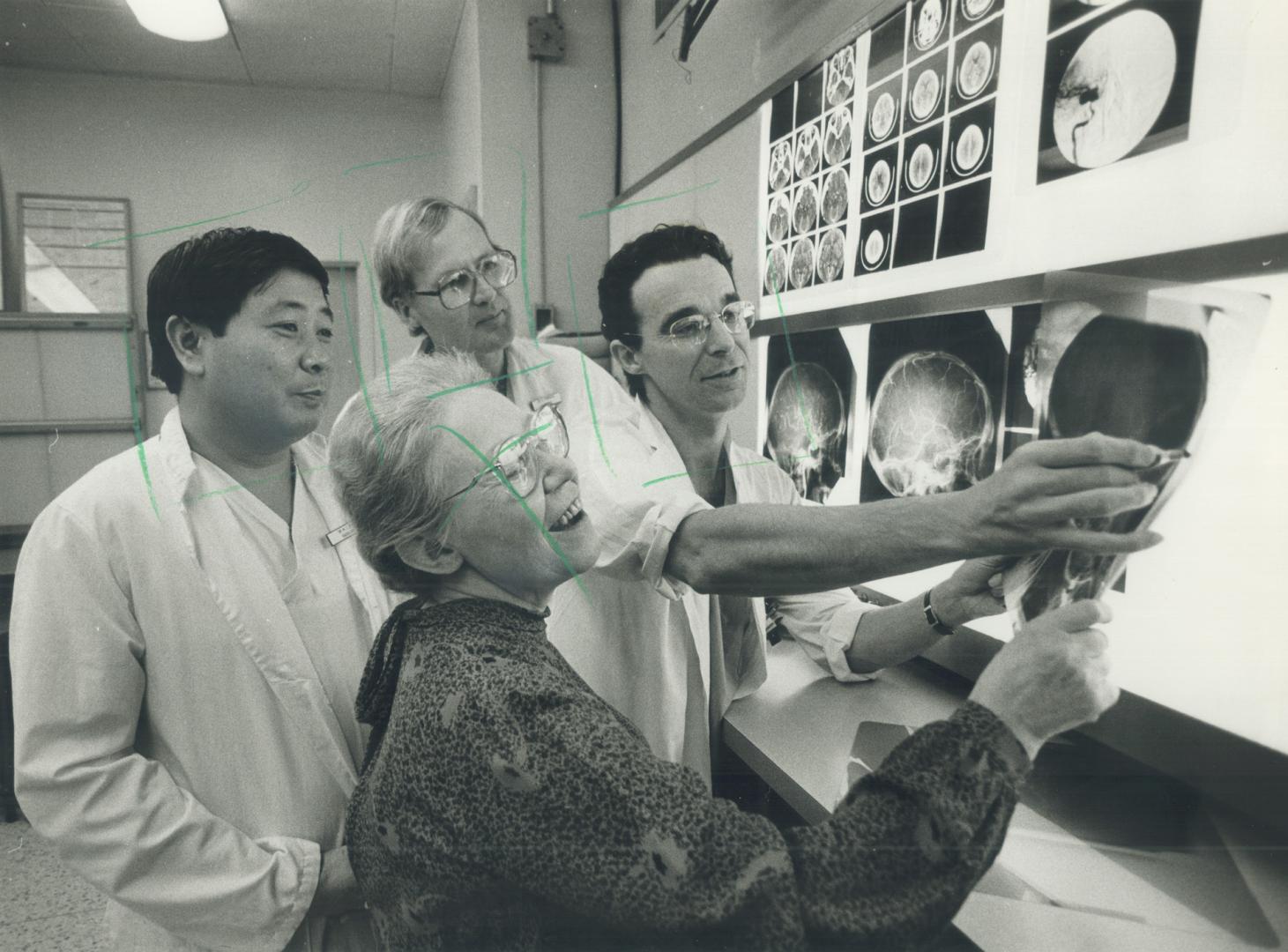 Happy patient: Toronto Western Hospital radiologists Drs. Ming-Chai Chiu and Karel TerBrugge, left, examine skull x-rays of Maria Wislohusova with Dr. Pierre Lasjaunias of Paris. Lasjaunias, who specializes in a new technique called embolization, worked with his colleagues to restore Wishohusova's sight.