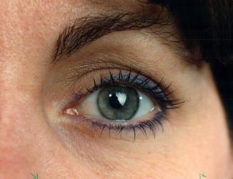 Human Anatomy - Eyes