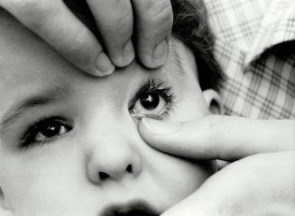 Brave boy: While Dr. Henry Brent (left) watches, Donna Ivany inserts and removes contact lenses from the eyes of her 19-month-old daughter, Amanda, at the Hospital for Sick Children